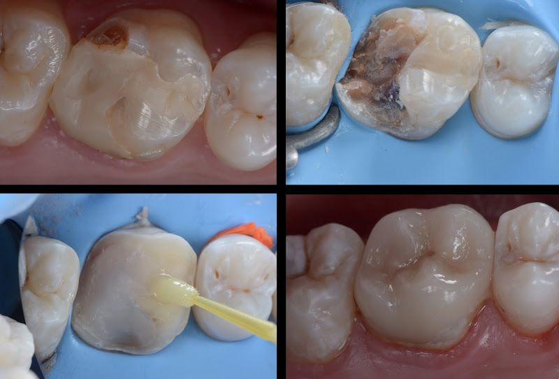 Foto 3 de Consultório Odontológico Dr. Marco A Carvalho - CBOE