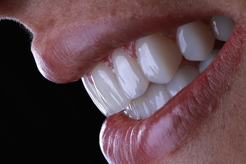 Foto 3 de Consultório Odontológico Dr. Matherson Noleto