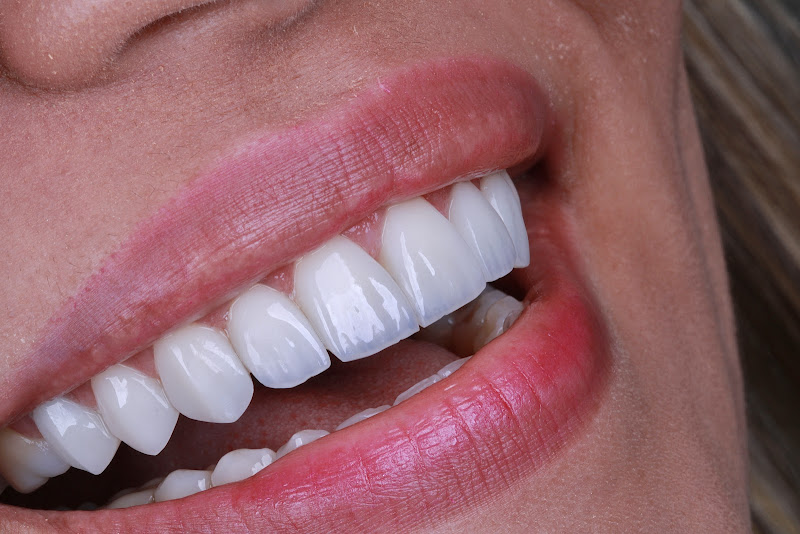 Foto 4 de Consultório Odontológico Dr. Matherson Noleto