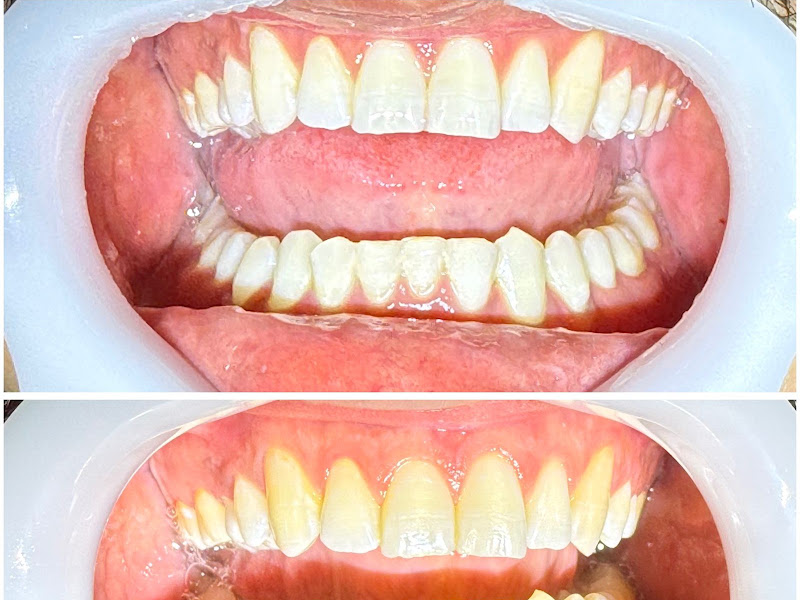 Foto 7 de Consultório Odontológico Dr. Paulo Eduardo Sartori