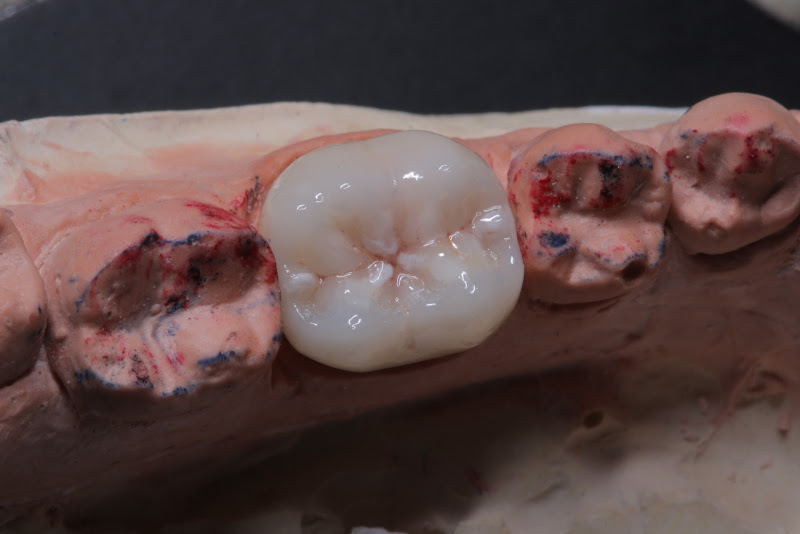 Foto 3 de Consultório Odontológico Dr Ricardo Reis - Odontoricks. Dentista BH