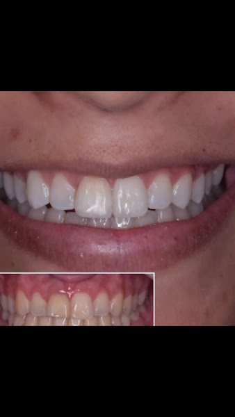 Foto 3 de Consultório Odontológico Dr Robert & Drª Elen | Dentista no Interlagos