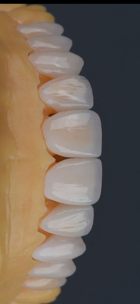 Foto 3 de Consultório Odontológico Dr. Rodrigo Rodrigues (Núcleo Harmoniza)