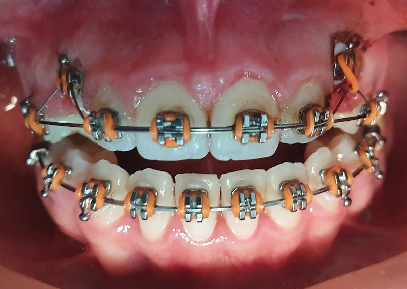 Foto 3 de Consultório Odontológico Dr. Rogério Costa de Melo