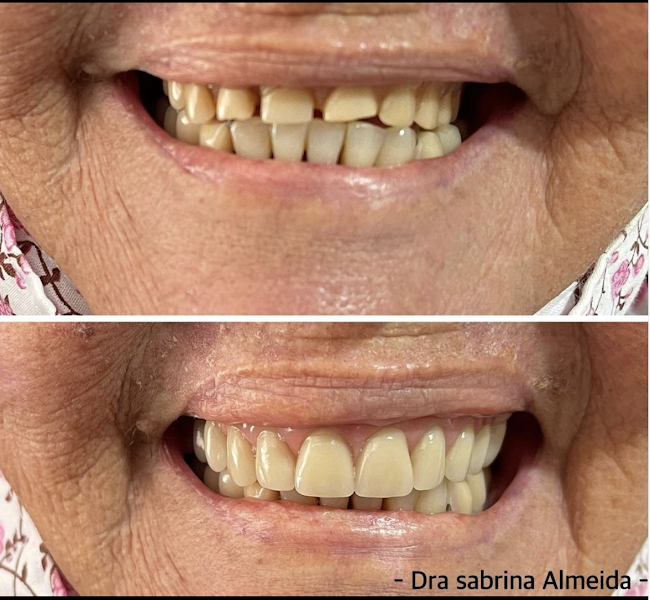 Foto 2 de Consultório Odontológico Drª Sabrina - Mauazinho (ao lado da Loteria)