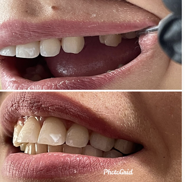 Foto 3 de Consultório Odontológico Drª Sabrina - Mauazinho (ao lado da Loteria)