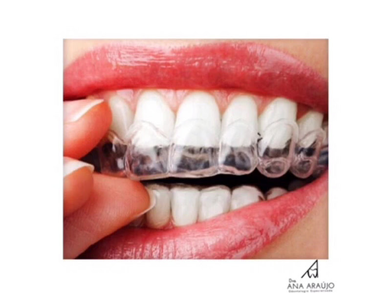 Foto 3 de Consultório Odontológico - Dr Sergio Rapozo e Dra Graziela Torres