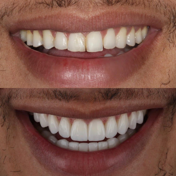 Foto 2 de CONSULTÓRIO ODONTOLÓGICO - Dr. WILLIAN BORRO (Unidade Presidente Prudente -Sp)