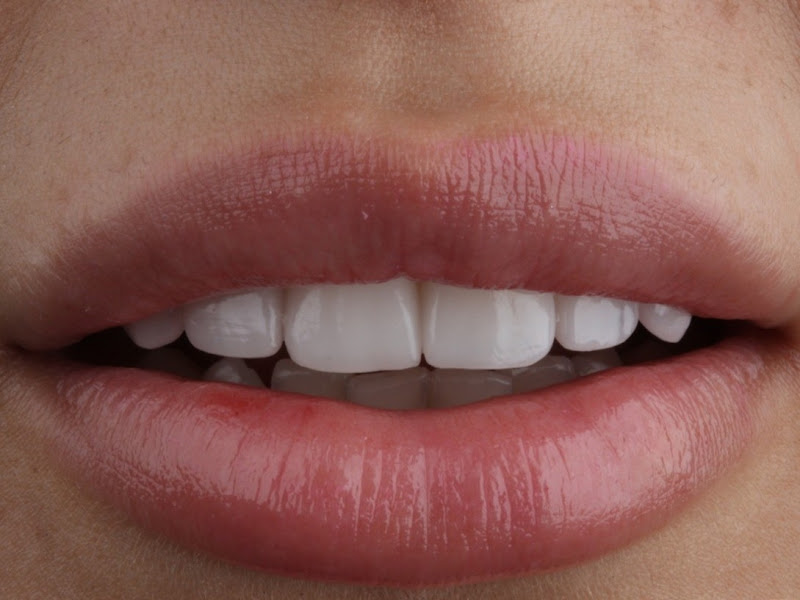 Foto 3 de CONSULTÓRIO ODONTOLÓGICO - Dr. WILLIAN BORRO (Unidade Presidente Prudente -Sp)