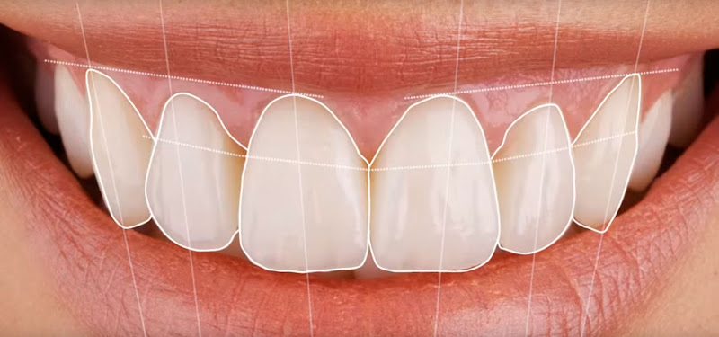 Foto 3 de Consultório Odontológico Dr. Wladimir Barbosa