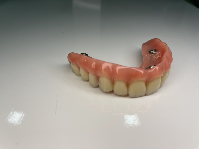 Foto 2 de Consultório Odontológico Dra Adfrancy Lemos; Dentista; Clareamento; Harmonização Facial; implante; Prótese; Canal.