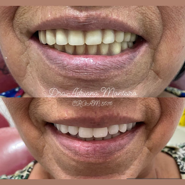 Foto 3 de Consultório odontológico Dra Adriana Monteiro