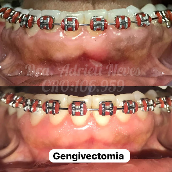 Foto 3 de Consultório Odontológico Dra. Adrieli Neves