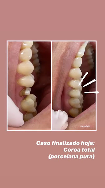 Foto 4 de Consultório Odontológico Dra Alyne Leal