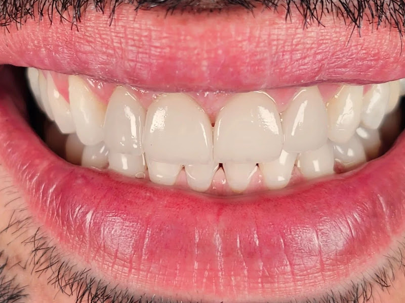 Foto 3 de Consultorio Odontologico Dra Ana Caroline Xavier