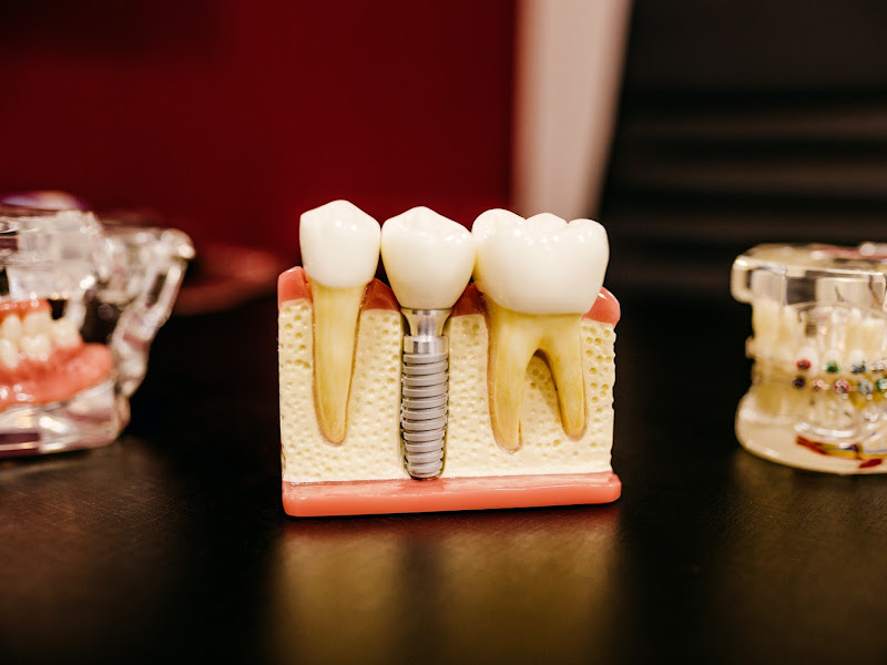 Foto 4 de Consultorio Odontologico Dra Ana Caroline Xavier