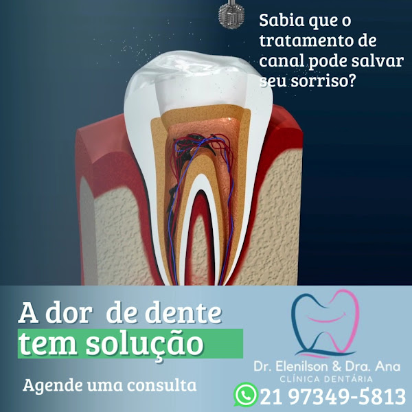 Foto 4 de Consultório Odontológico Dra. Ana & Dr. Elenilson