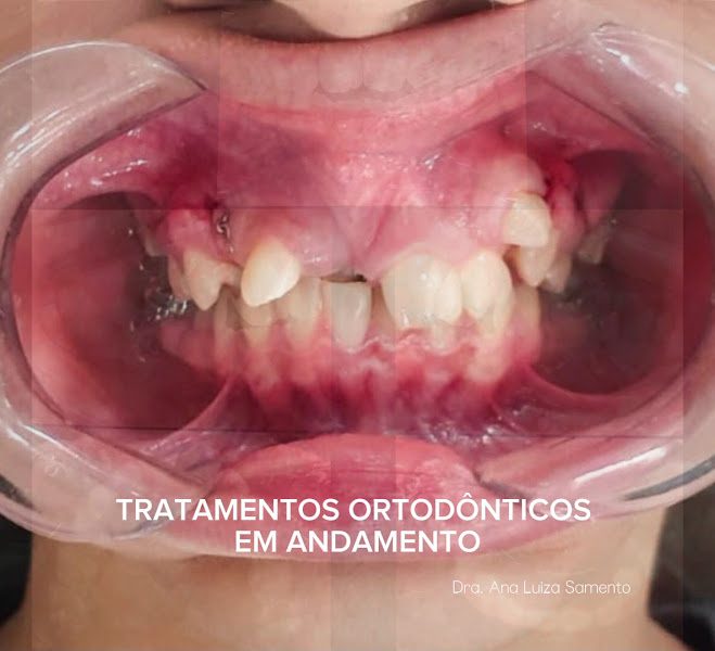 Foto 4 de Consultório Odontológico Dra Ana Luiza | Ortodontia | Odontopediatria | Dentista em Ananindeua - Cidade Nova