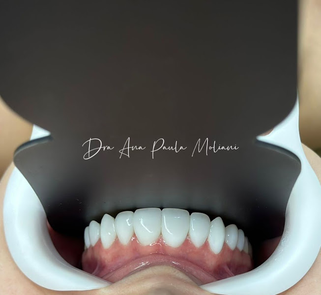 Foto 2 de Consultório Odontológico Dra. Ana Paula Moliani