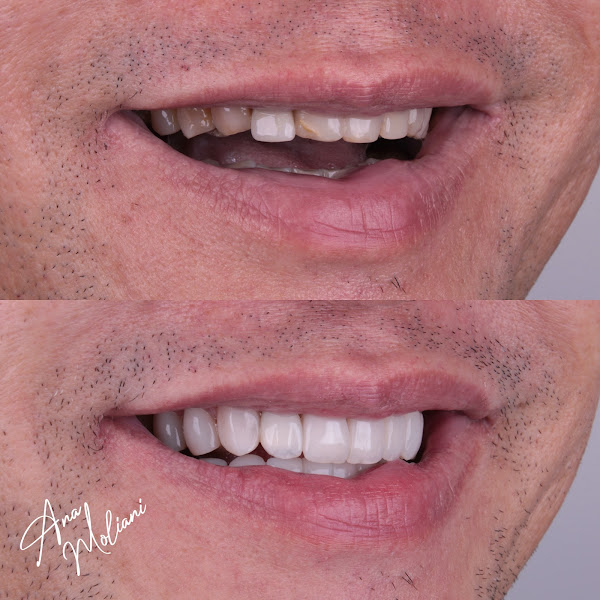 Foto 3 de Consultório Odontológico Dra. Ana Paula Moliani