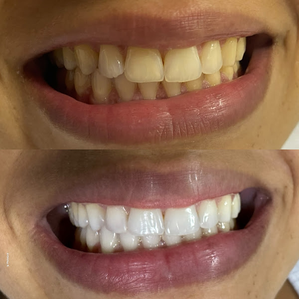 Foto 3 de Consultório Odontológico Dra Bárbara Azevedo