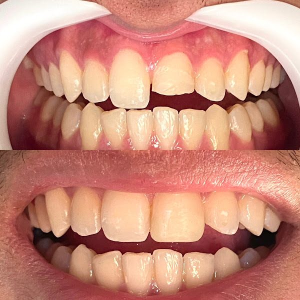 Foto 2 de Consultório Odontológico - Dra Beatriz Ferreira e Dra Júlia Mesquita