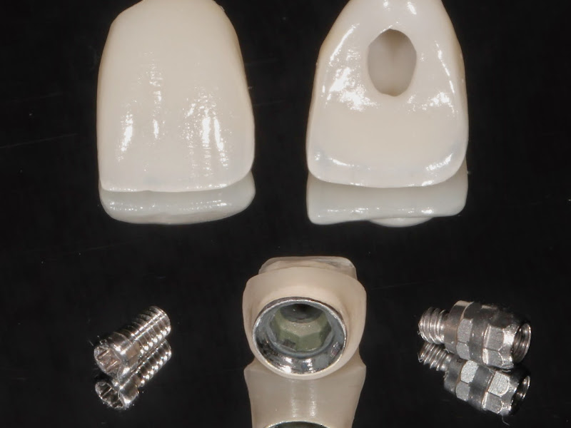 Foto 3 de Consultório Odontológico Dra. Brenda Brito Berçot