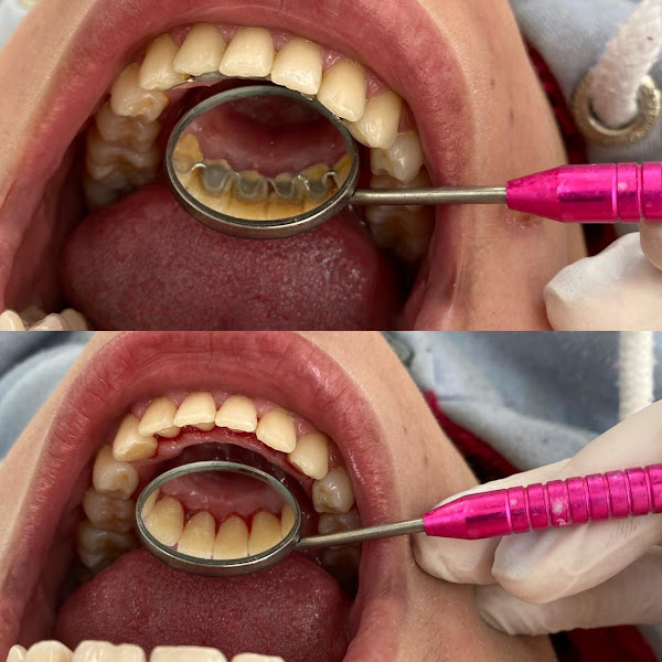 Foto 2 de Consultório Odontológico - Dra. Bruna Espindola Libert