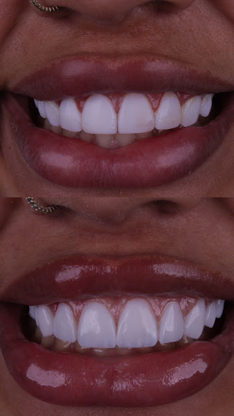 Foto 3 de Consultório Odontológico - Dra. Bruna Espindola Libert