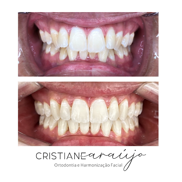 Foto 3 de Consultório Odontológico Dra Cristiane Araújo