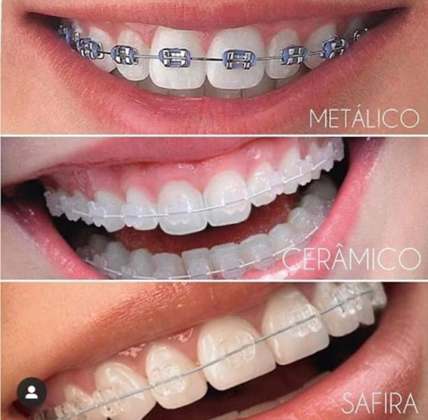 Foto 2 de Consultório Odontológico Dra.Cristiane Valeska Moura