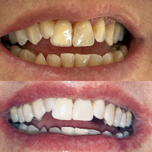 Foto 2 de Consultório Odontológico Dra. Djenanda Freire & Dra. Patrícia Malta