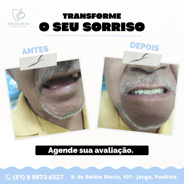 Foto 2 de Consultório Odontológico Dra. Edilma Silva - Cirurgiã Dentista