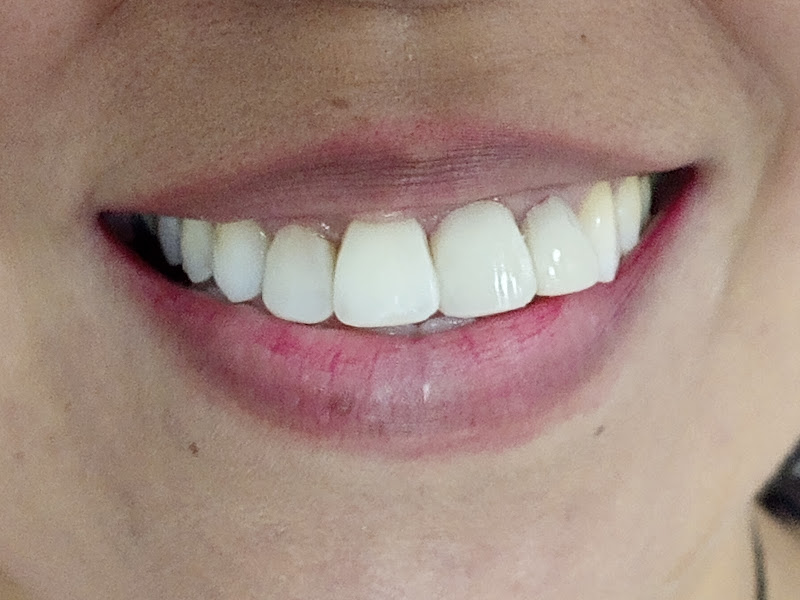 Foto 2 de Consultório odontológico Dra Ellen Rachel Arruda