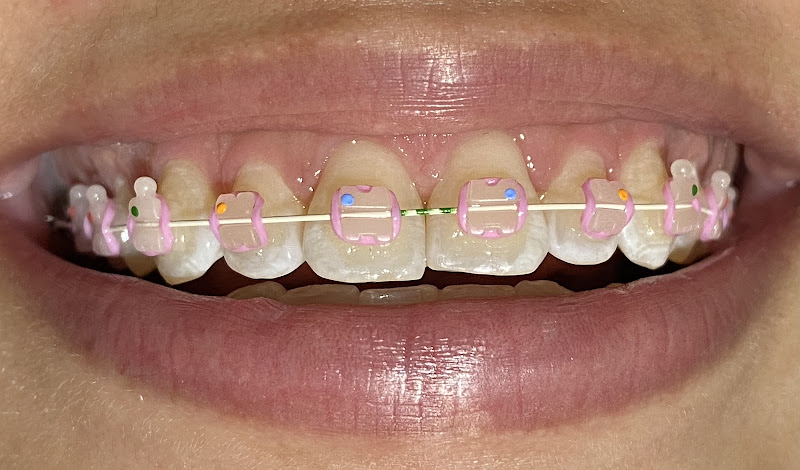 Foto 3 de Consultório Odontológico Dra. Flávia Vieira