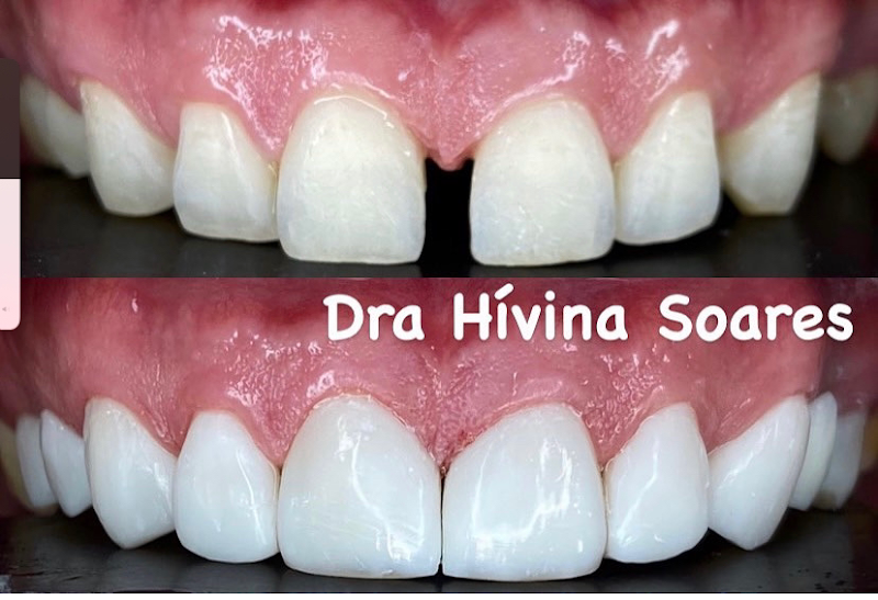 Foto 3 de Consultório Odontológico Dra Hívina Soares