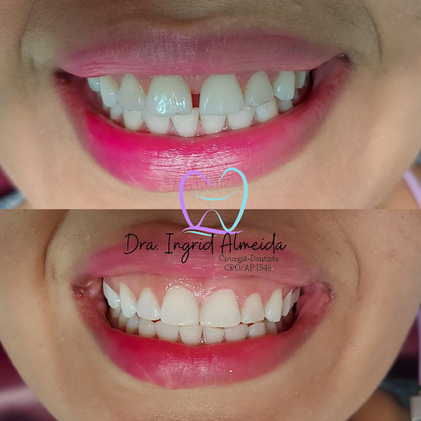 Foto 3 de Consultório Odontológico Dra. Ingrid Almeida