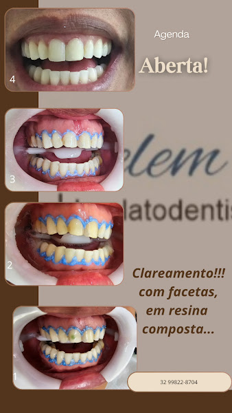 Foto 3 de Consultório odontológico Dra. Jocielem Landim