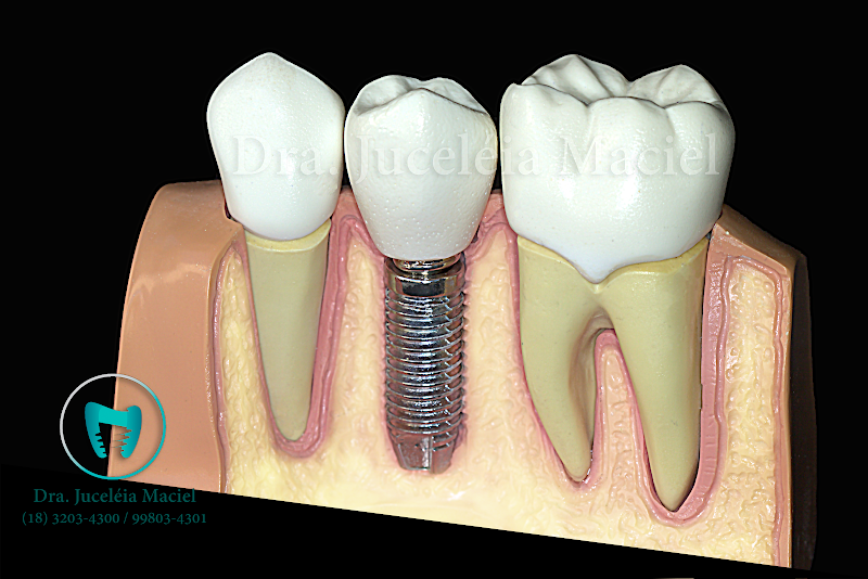 Foto 3 de Consultório Odontológico Dra. Juceléia Maciel