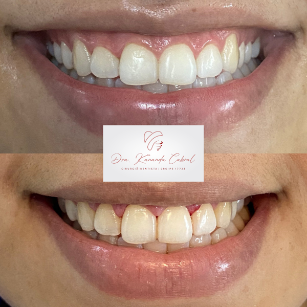 Foto 2 de Consultório Odontológico Dra. Kananda Cabral