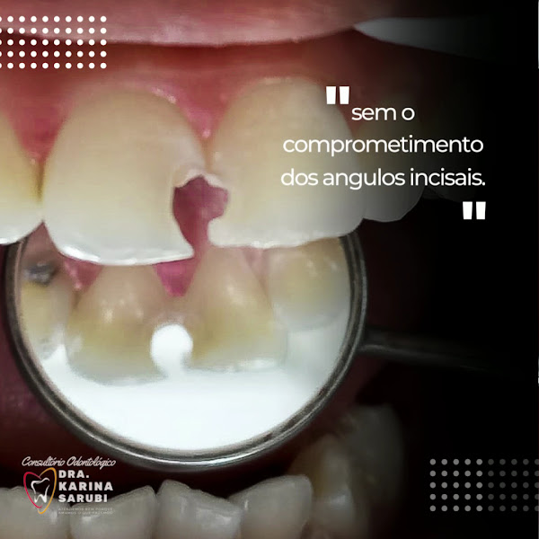 Foto 3 de Consultório Odontológico Dra. Karina Sarubi