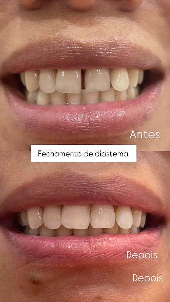 Foto 2 de Consultório odontológico Dra. Keysla Santos