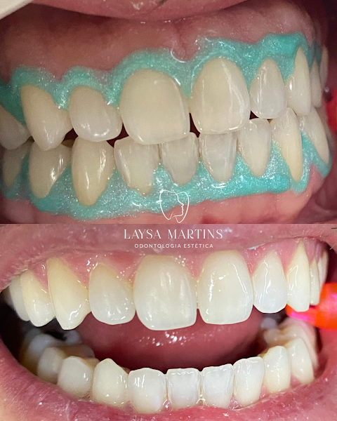 Foto 2 de Consultório Odontológico Dra Laysa Martins