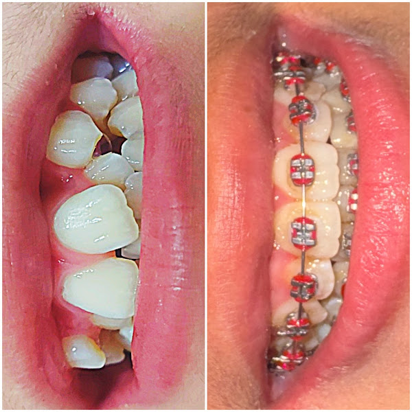 Foto 3 de Consultório Odontológico Dra Leila Lima