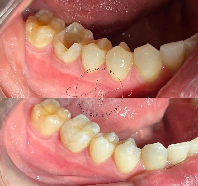 Foto 3 de Consultório Odontológico Dra Letícia Gomes