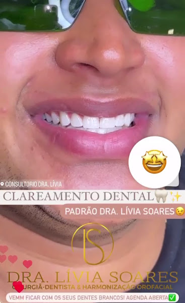 Foto 3 de Consultório Odontológico Dra Lívia Soares
