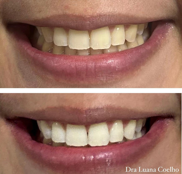 Foto 2 de Consultório Odontológico Dra Luana Coelho