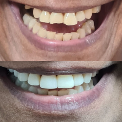 Foto 2 de Consultório Odontológico Dra Luci Alves