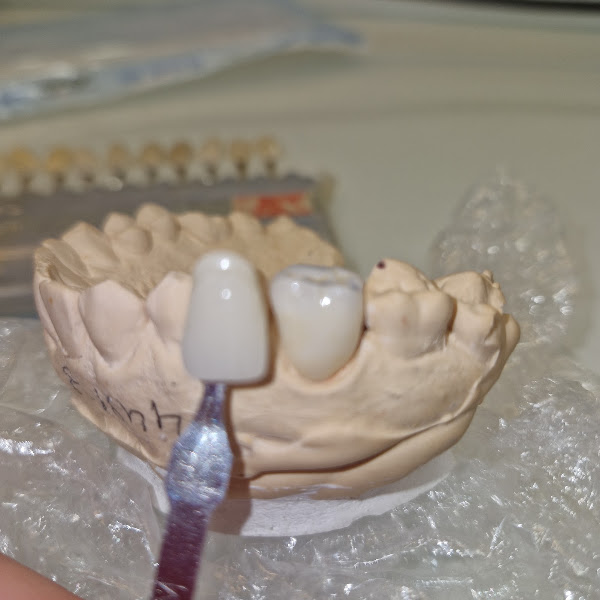 Foto 3 de Consultório Odontologico dra Luciene Valino