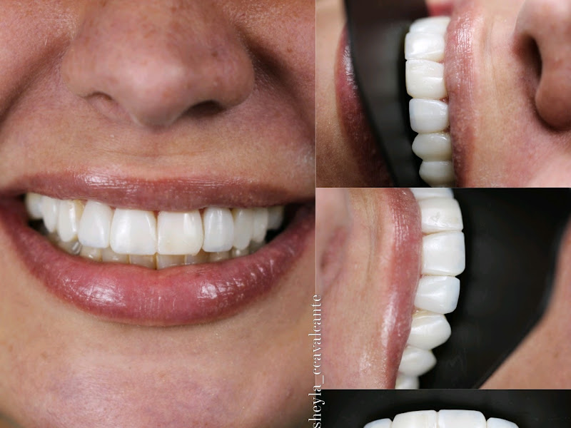 Foto 3 de Consultório Odontológico Dra. Micaella Seixas